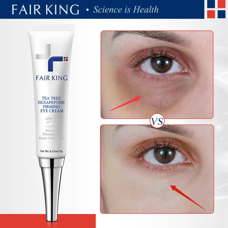 FAIR KING Anti-Wrinkle Eye Cream Removes Dark Fine Line Circles Bags Whitening Healthy Firmness Moisturizing Beauty Care Tools